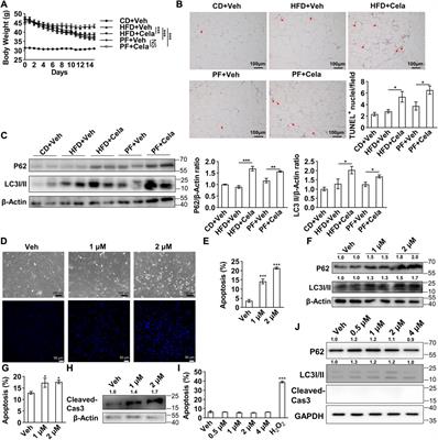 Celastrol directly binds with VAMP7 and RAB7 to inhibit autophagy and induce apoptosis in preadipocytes